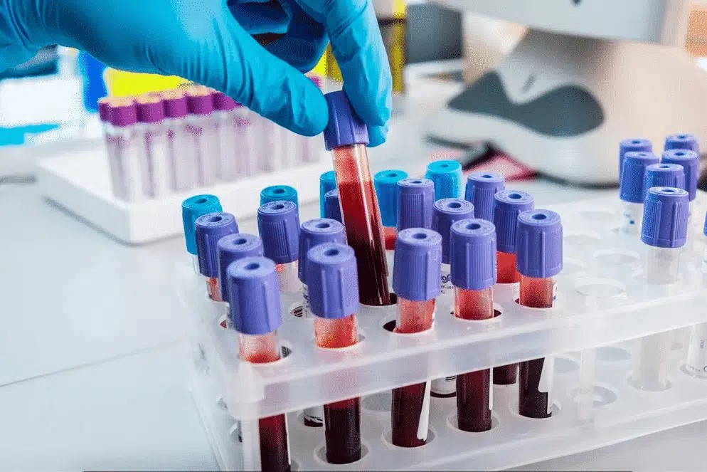 Understanding Blood Tests