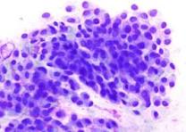 Cytology Tests