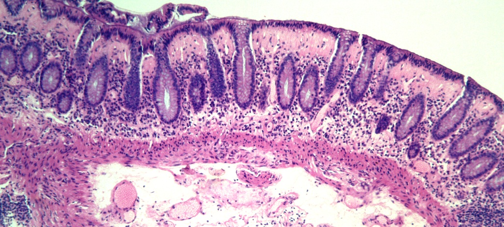 Histopathology Tests